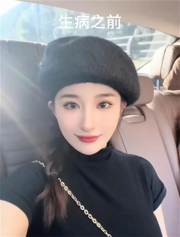 湖南26岁渐冻症女生离世，曾向蔡磊求助，“等不到春暖花开了”